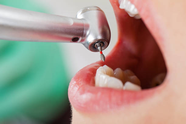 Best Dentist for Tooth Abscess  in Hayti, MO